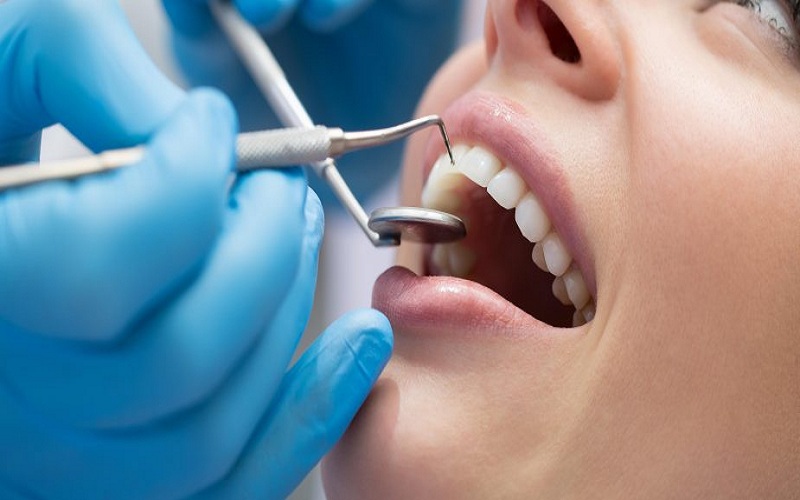 Expertise of General Dentists