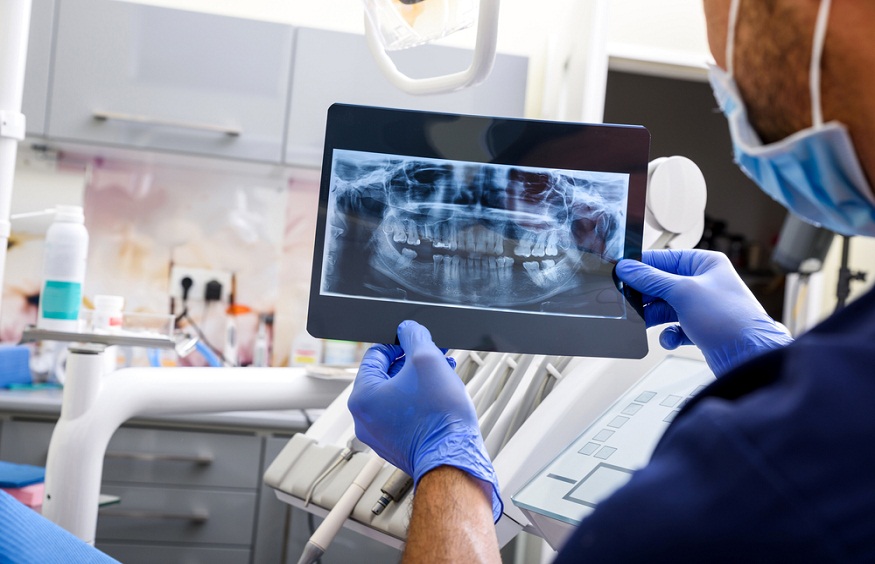 Decoding Dental X-Rays