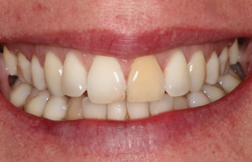 Cosmetic dentistry in Plymouth